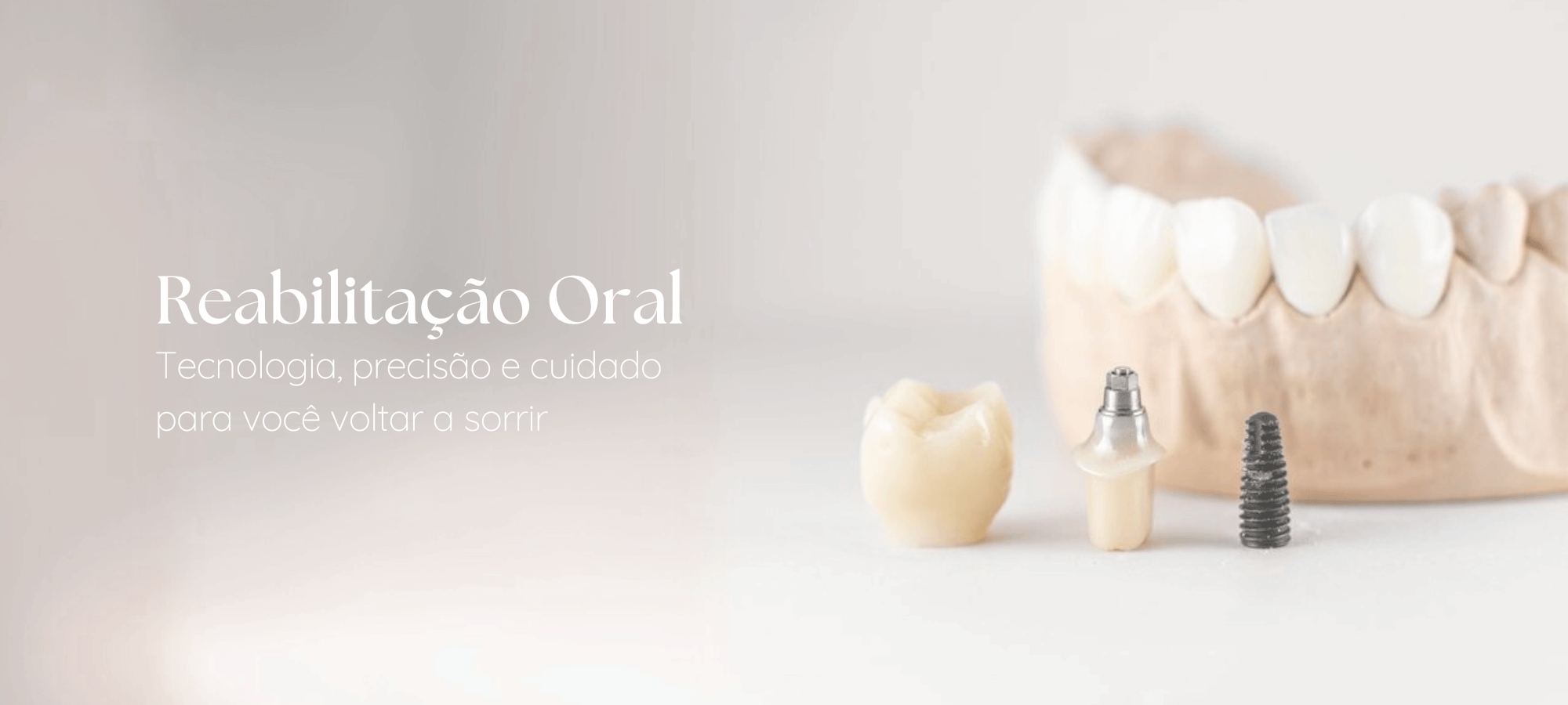 ville-odonto-destaques-reabilitacao-oral-tiny